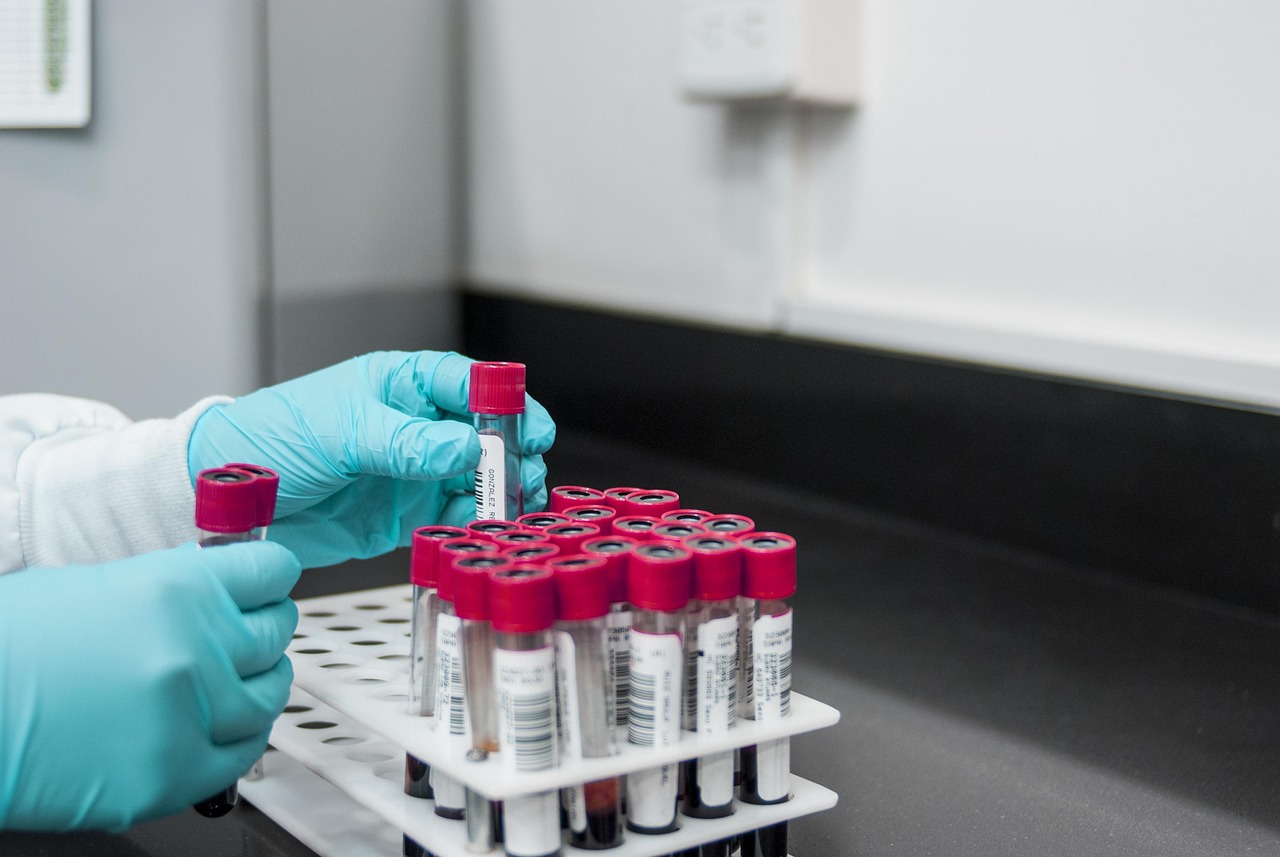 Temmuz Ayında 11 Yeni HIV/AIDS Vakası Bildirildi